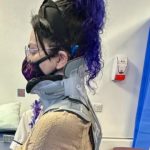Mulher com doença rara volta a ficar de pé após cirurgia inovadora