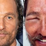 Matthew McConaughey preocupa fãs ao surgir com olho (muito) inchado
