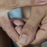 Dermatite atópica afeta pele, sono e saúde mental, alertam especialistas