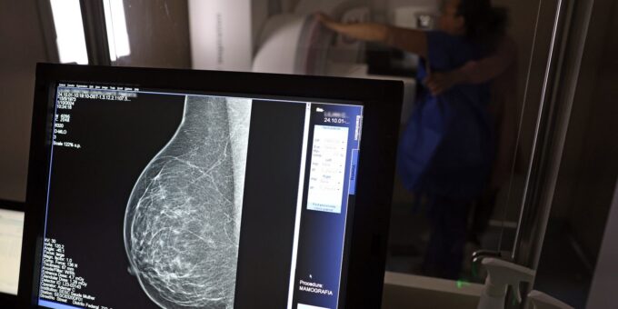 Planos de saúde terão que cobrir mamografia digital para todas as idades