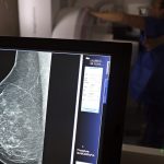 Entidades orientam médicos sobre pedidos de mamografia digital