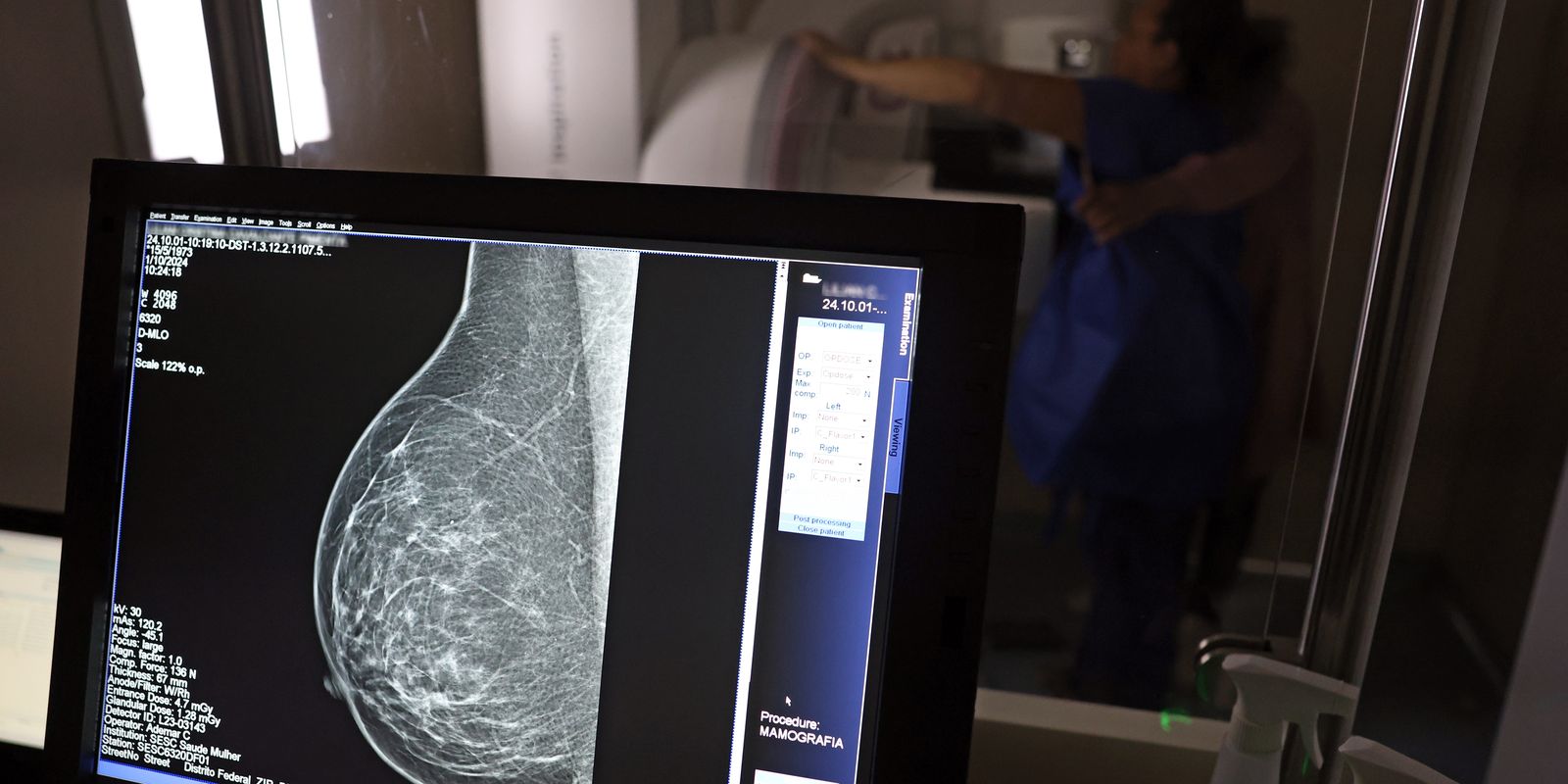 Entidades orientam médicos sobre pedidos de mamografia digital